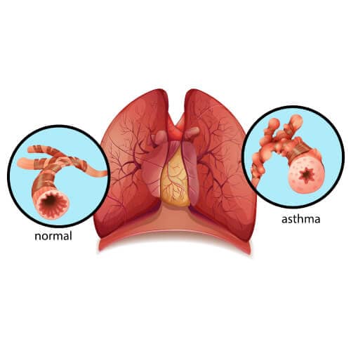 asthma pulmonologist in south delhi